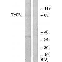 Rabbit Polyclonal Antibody to TAF5