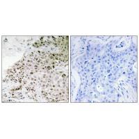 Rabbit Polyclonal Antibody to TAF13