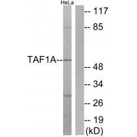 Rabbit Polyclonal Antibody to TAF1A