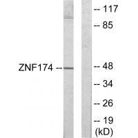 Rabbit Polyclonal Antibody to ZNF174