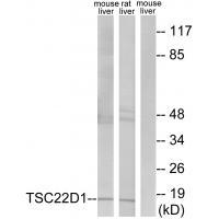 Rabbit Polyclonal Antibody to TSC22D1