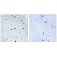 Rabbit Polyclonal Antibody to ZFHX3