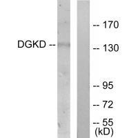 Rabbit Polyclonal Antibody to DGKD