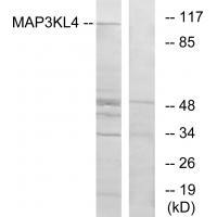 Rabbit Polyclonal Antibody to MAP3KL4