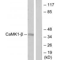 Rabbit Polyclonal Antibody to CaMK1-β