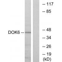 Rabbit Polyclonal Antibody to DOK6