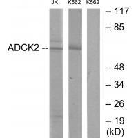 Rabbit Polyclonal Antibody to ADCK2