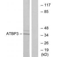 Rabbit Polyclonal Antibody to ATBP3