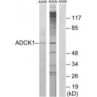 Rabbit Polyclonal Antibody to ADCK1