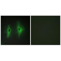Rabbit Polyclonal Antibody to DGKH