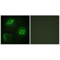 Rabbit Polyclonal Antibody to LATH