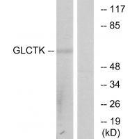 Rabbit Polyclonal Antibody to GLCTK