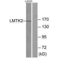 Rabbit Polyclonal Antibody to LMTK2