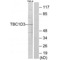 Rabbit Polyclonal Antibody to TBC1D3