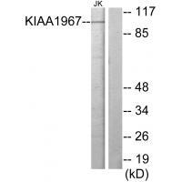 Rabbit Polyclonal Antibody to KIAA1967