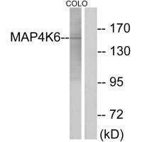 Rabbit Polyclonal Antibody to MAP4K6
