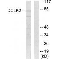 Rabbit Polyclonal Antibody to DCLK2