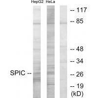 Rabbit Polyclonal Antibody to SPIC