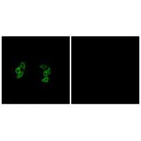 Rabbit Polyclonal Antibody to CKI-α1/L