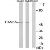 Rabbit Polyclonal Antibody to CAMK5