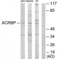 Rabbit Polyclonal Antibody to ACRBP