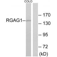 Rabbit Polyclonal Antibody to RGAG1
