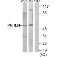Rabbit Polyclonal Antibody to PPHLN
