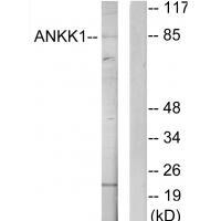 Rabbit Polyclonal Antibody to ANKK1