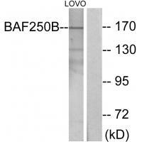 Rabbit Polyclonal Antibody to BAF250B