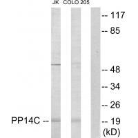 Rabbit Polyclonal Antibody to PP14C