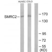 Rabbit Polyclonal Antibody to SMRC2