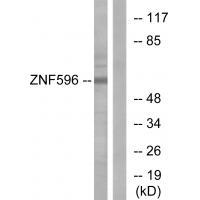 Rabbit Polyclonal Antibody to ZNF596