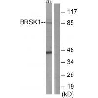 Rabbit Polyclonal Antibody to BRSK1