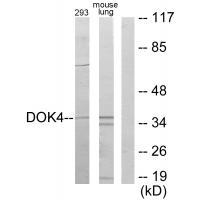 Rabbit Polyclonal Antibody to DOK4