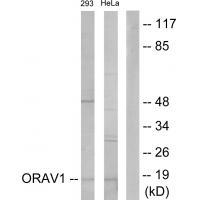 Rabbit Polyclonal Antibody to ORAV1