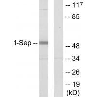Rabbit Polyclonal Antibody to 45170
