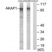 Rabbit Polyclonal Antibody to AKAP1