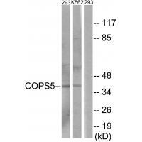 Rabbit Polyclonal Antibody to COPS5