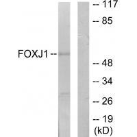 Rabbit Polyclonal Antibody to FOXJ1