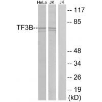 Rabbit Polyclonal Antibody to TF3B