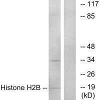 Rabbit Polyclonal Antibody to Histone H2B