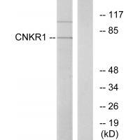 Rabbit Polyclonal Antibody to CNKR1