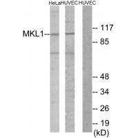 Rabbit Polyclonal Antibody to MKL1