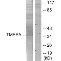 Rabbit Polyclonal Antibody to TMEPA
