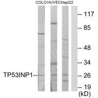 Rabbit Polyclonal Antibody to TP53INP1