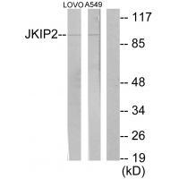 Rabbit Polyclonal Antibody to JKIP2