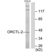 Rabbit Polyclonal Antibody to ORCTL-2