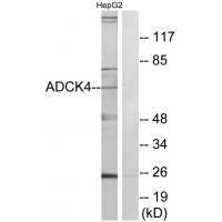 Rabbit Polyclonal Antibody to ADCK4