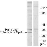 Rabbit Polyclonal Antibody to HES6