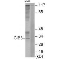 Rabbit Polyclonal Antibody to CIB3